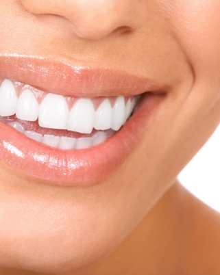 Les jours après… Le détartrage (le calvaire dentaire)